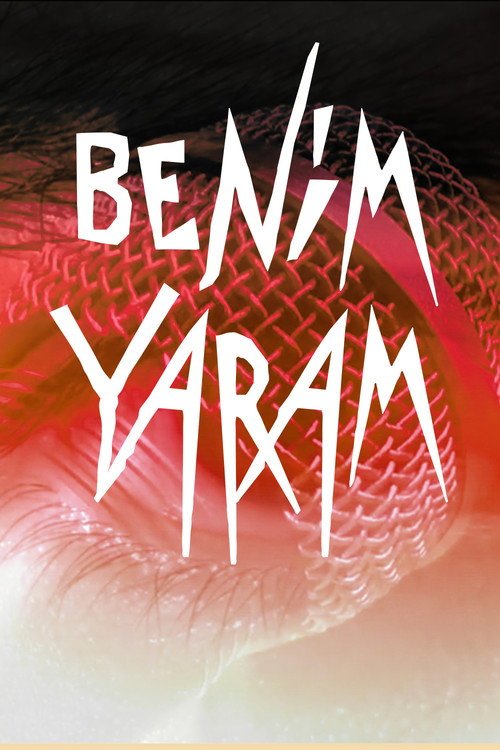 Benim Yaram (Senin Yarandan Büyük) afişi